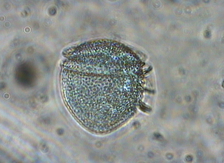 Dictyocha speculum
